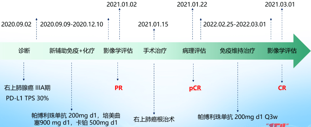 最新肺病进展，突破与创新的治疗策略